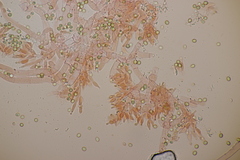 Trichoderma gelatinosum
