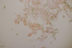 Trichoderma gelatinosum