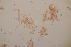 Trichoderma gelatinosum