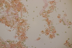 Trichoderma gelatinosum