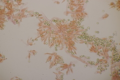 Trichoderma gelatinosum