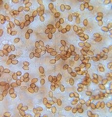 Glaucopodes