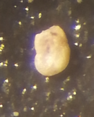 Glomospira fijiensis