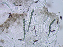 Chaenothecopsis