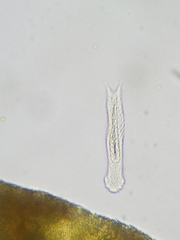 Gastrotricha