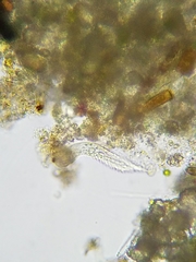 Gastrotricha