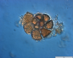 Elphidium