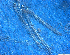 Calothrix confervicola