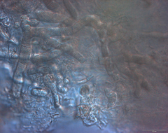 Mastigocoleus testarum