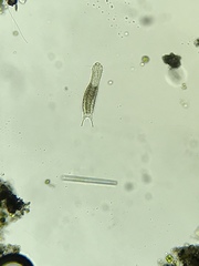 Gastrotricha