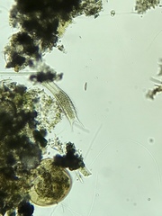 Gastrotricha