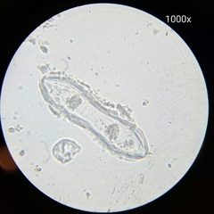 Surirella librile