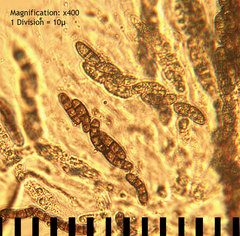 Chaetosphaerella phaeostroma