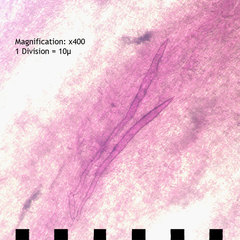 Inonotus quercustris image