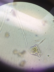 Vorticella
