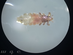 Pediculus humanus
