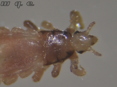 Pediculus humanus