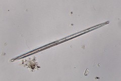 Ulnaria ulna