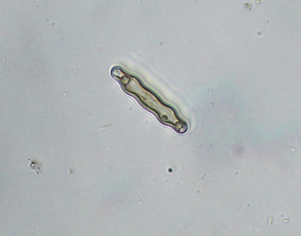 Pinnularia mesolepta