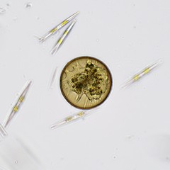 Arcella hemisphaerica