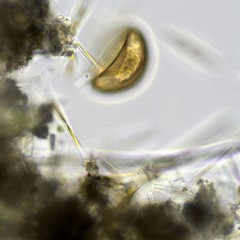 Arcella hemisphaerica