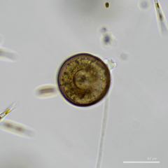 Arcella hemisphaerica