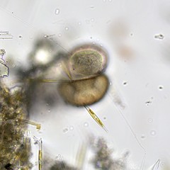 Arcella hemisphaerica