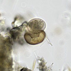 Arcella hemisphaerica