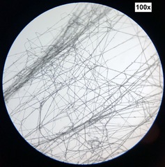 Sclerotinia sclerotiorum