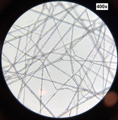 Sclerotinia sclerotiorum