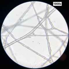 Sclerotinia sclerotiorum