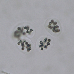 Microcystis wesenbergii