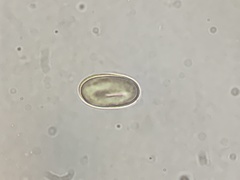 Pseudombrophila cervaria