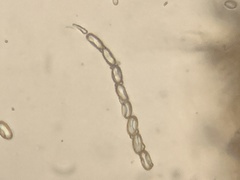 Pseudombrophila cervaria