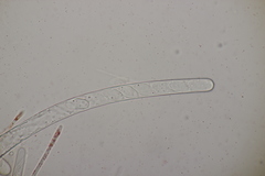 Sarcoscypha austriaca