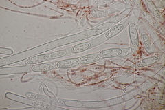 Sarcoscypha austriaca