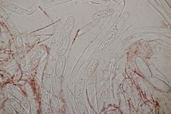 Sarcoscypha austriaca