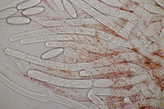 Sarcoscypha austriaca