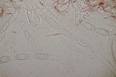 Sarcoscypha austriaca