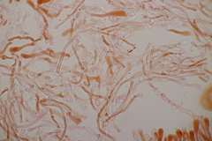 Cartilosoma rene-hentic