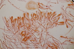 Cartilosoma rene-hentic