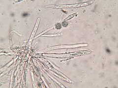 Trichopeziza