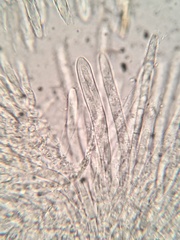 Trichopeziza