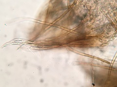 Trichopeziza