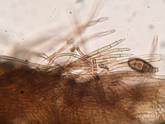 Trichopeziza