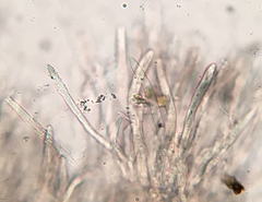 Trichopeziza
