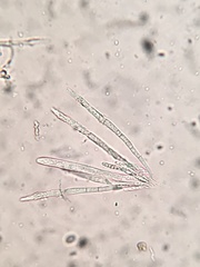 Trichopeziza