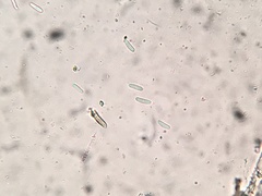 Trichopeziza