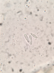 Trichopeziza