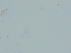 Cylindrobasidium laeve